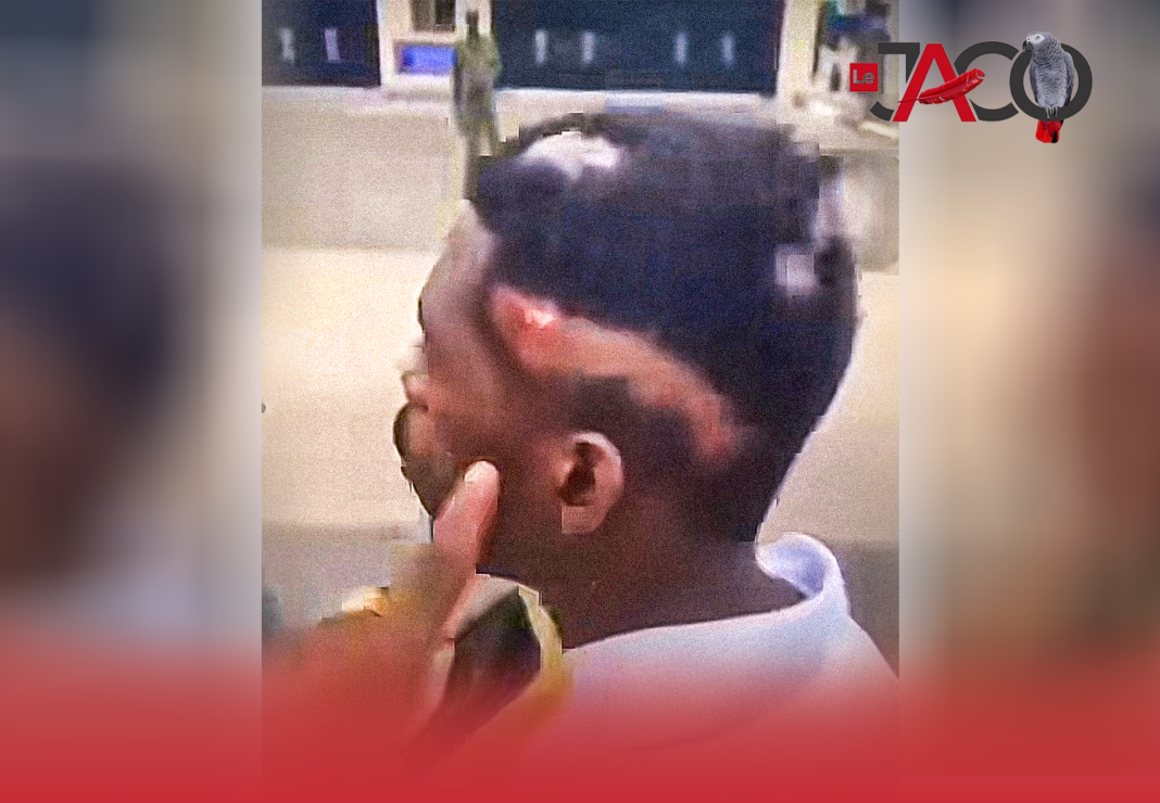 Rasage Forcé et Risques Sanitaires : Quand la Sécurité Viole la Dignité